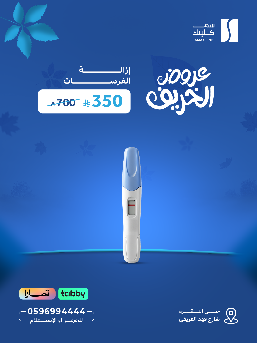 إزالة الغرسات