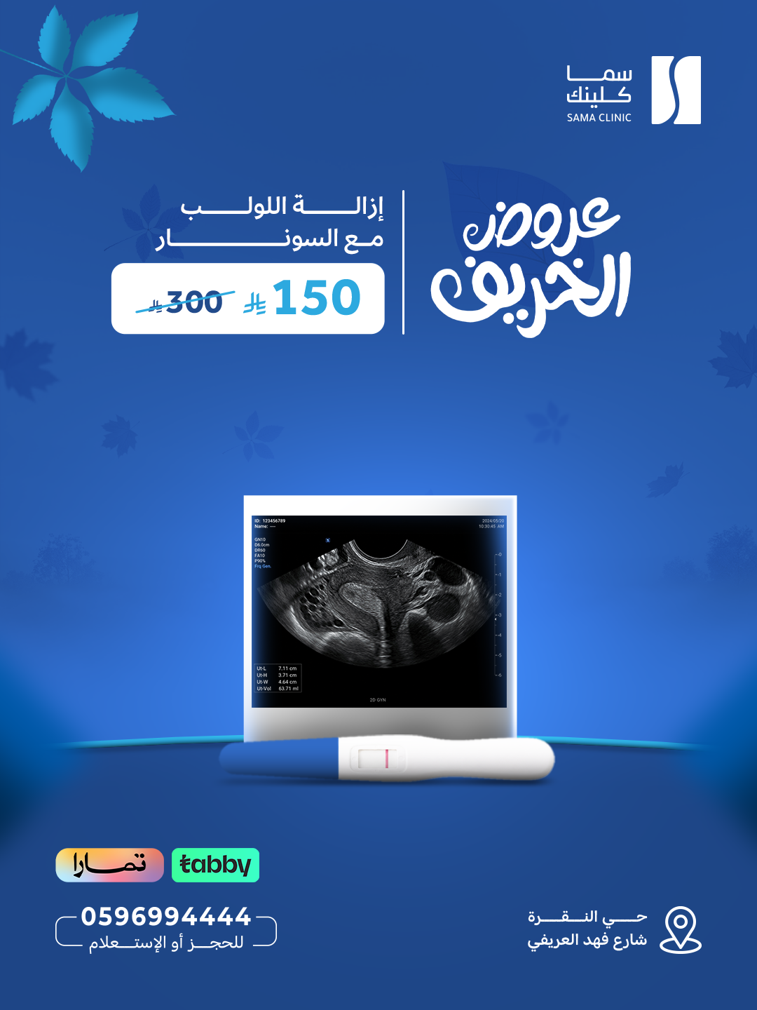 إزالة اللولب مع السونار