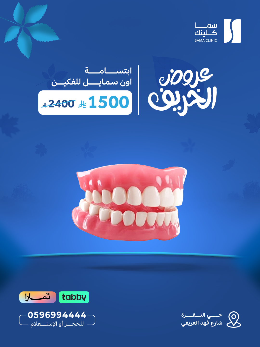 ابتسامة اون سمايل للفكين