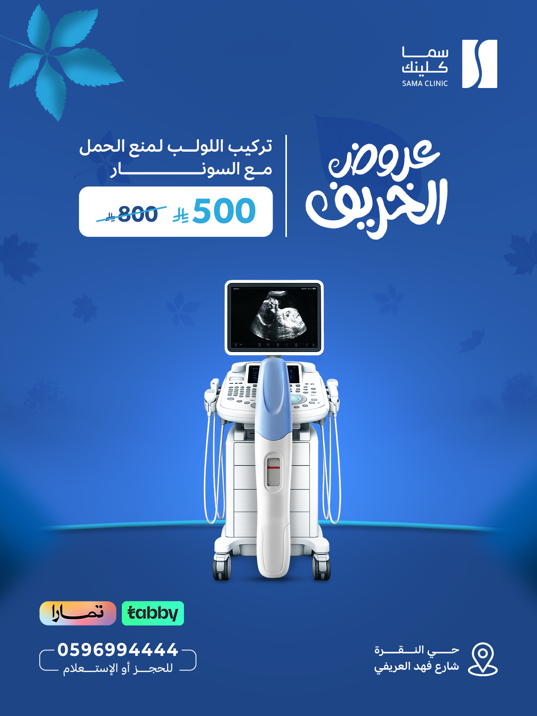 تركيب اللولب لمنع الحمل مع السونار