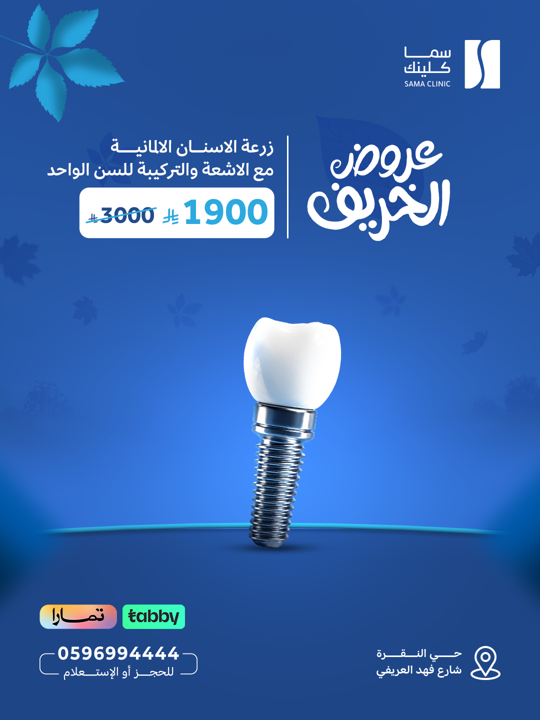 زرعة الاسنان الالمانية مع الاشعة والتركيبة للسن الواحد