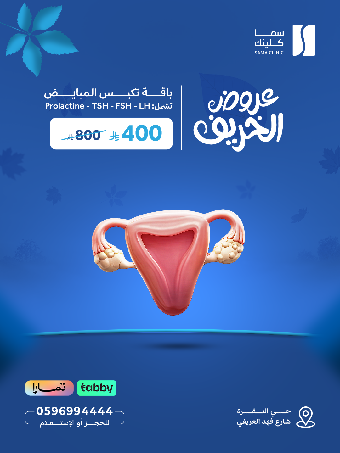 باقة تكيس المبايض