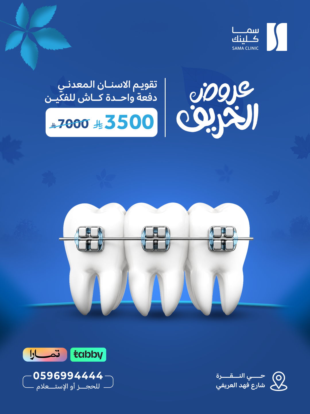 تقويم الاسنان المعدني دفعة واحدة كاش للفكين