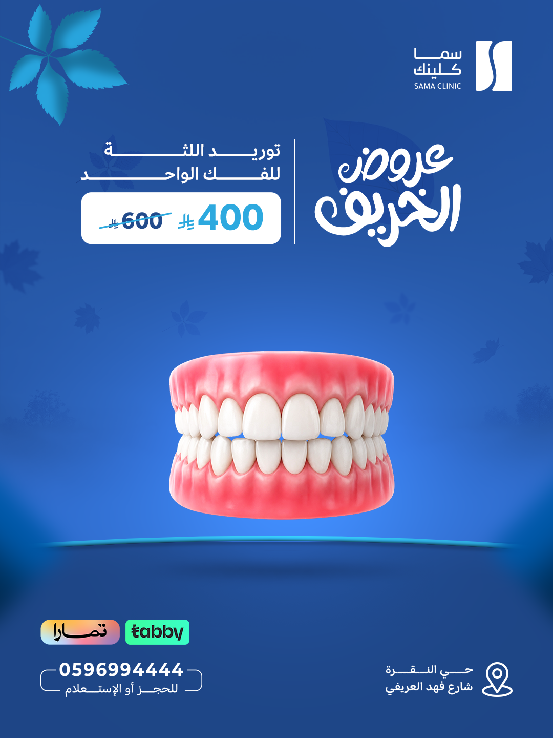 توريد اللثة للفك الواحد