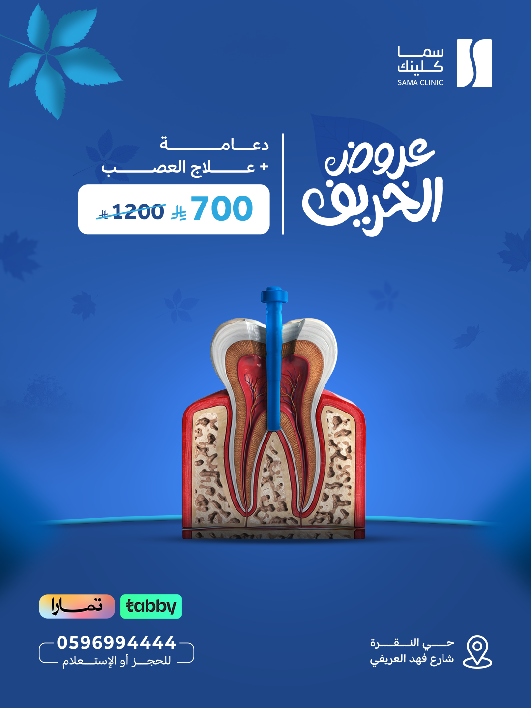 دعامة + علاج العصب