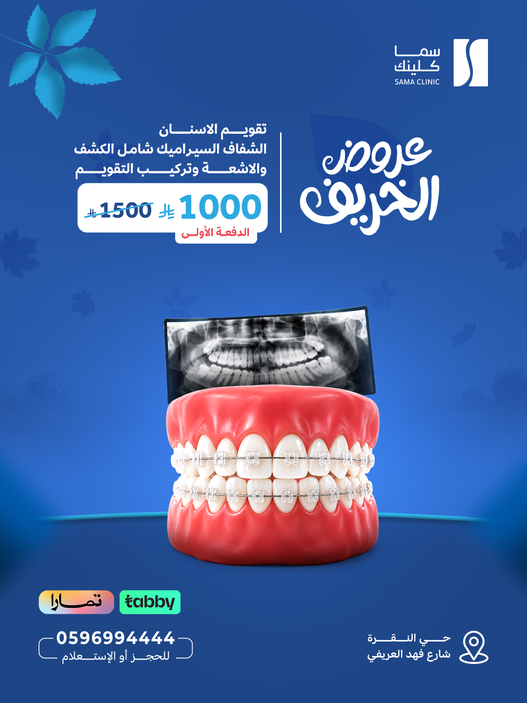 تقويم الاسنان الشفاف السيراميك شامل الكشف والاشعة وتركيب التقويم