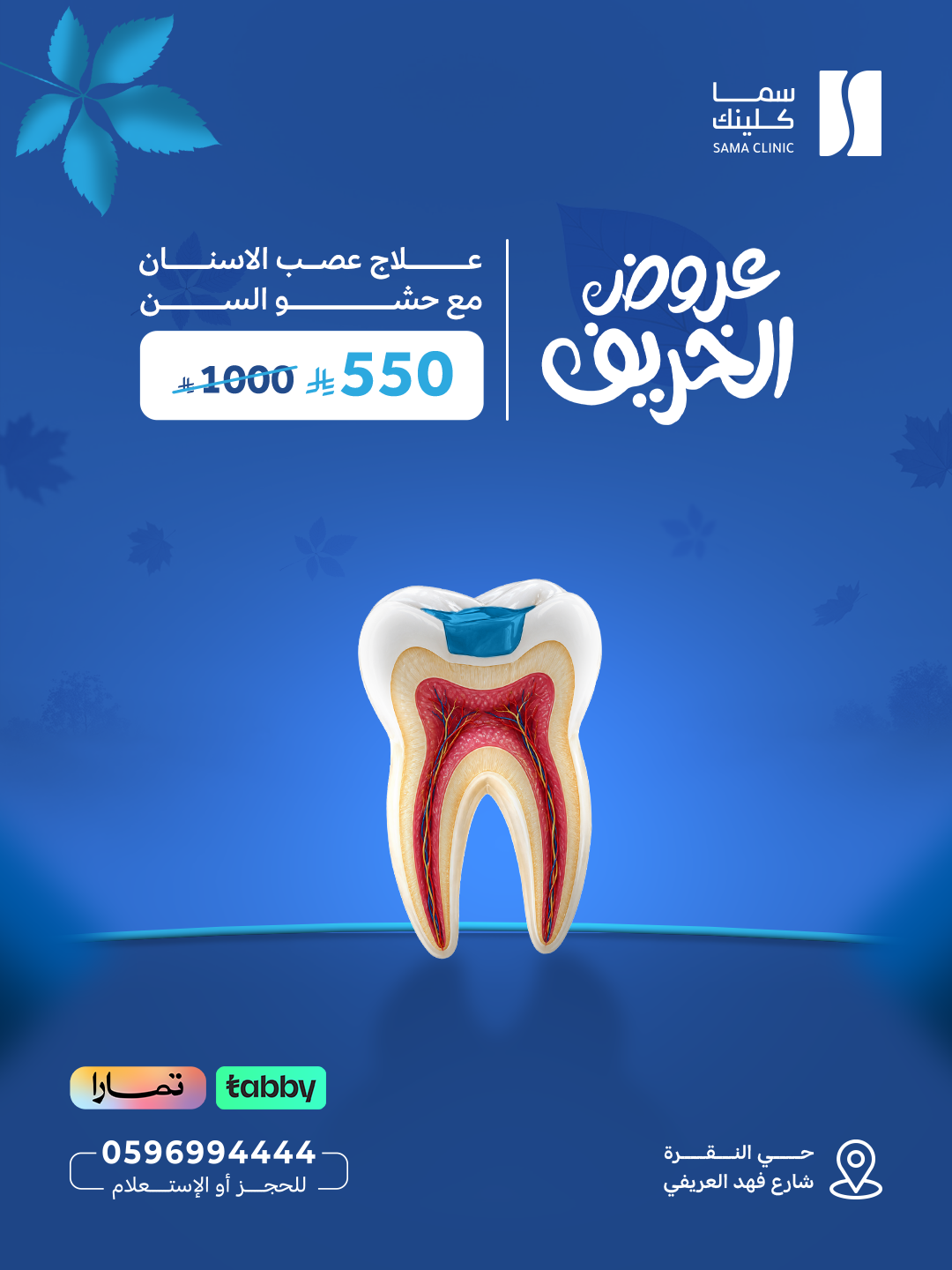 علاج عصب الاسنان مع حشو السن